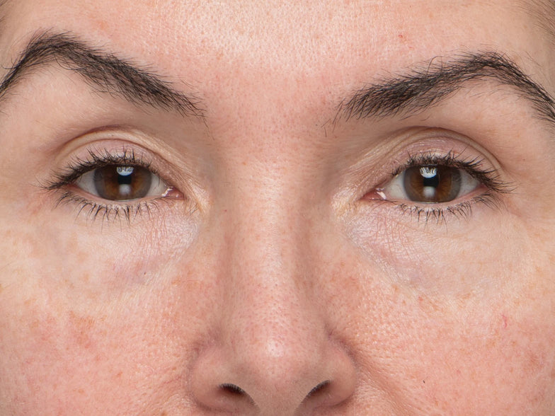 after face photo using product